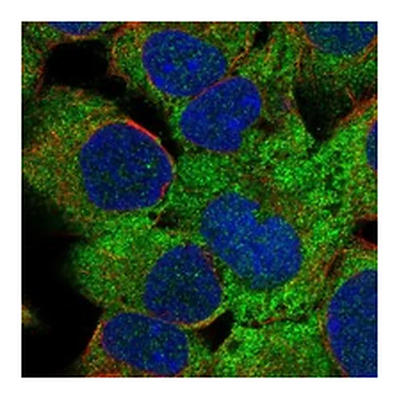 Atlas Antibodies Anti-ZBTB45 Antibody