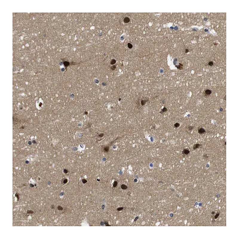 Atlas Antibodies Anti-ZBTB46 Antibody