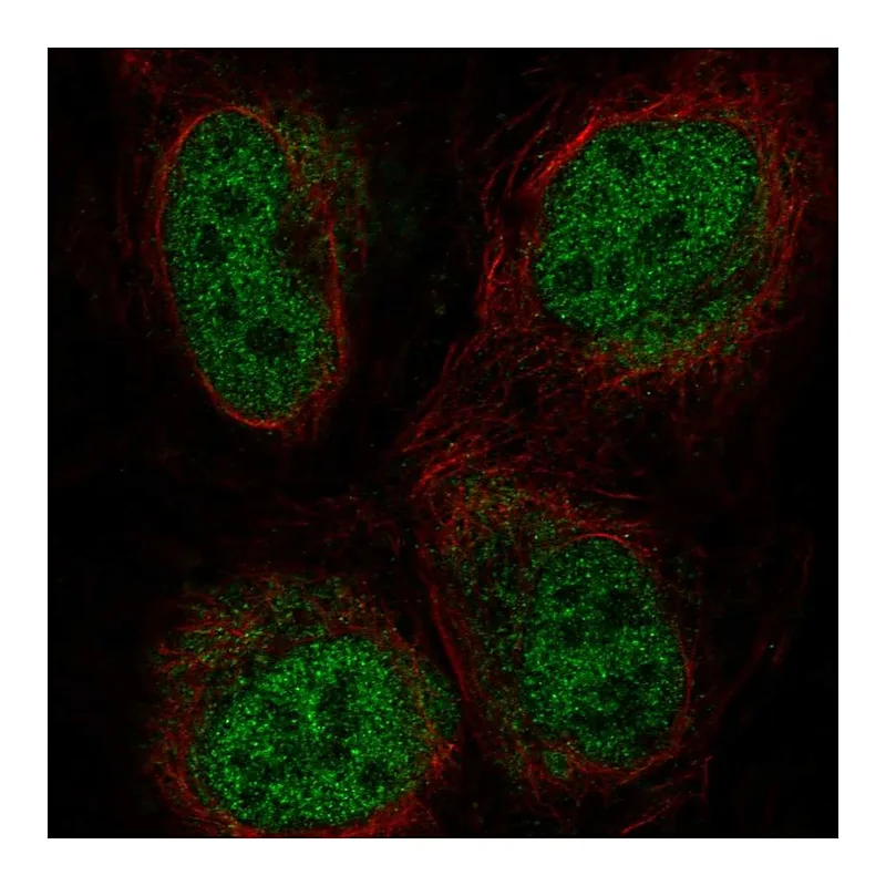 Atlas Antibodies Anti-ZBTB47 Antibody