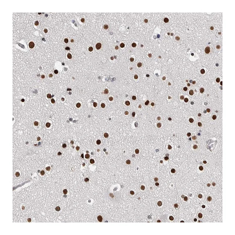 Atlas Antibodies Anti-ZBTB49 Antibody