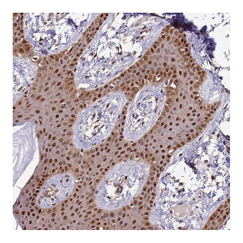 Atlas Antibodies Anti-ZBTB5 Antibody