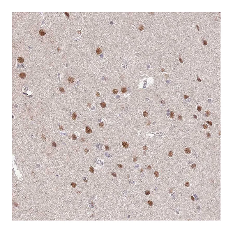 Atlas Antibodies Anti-ZBTB7A Antibody