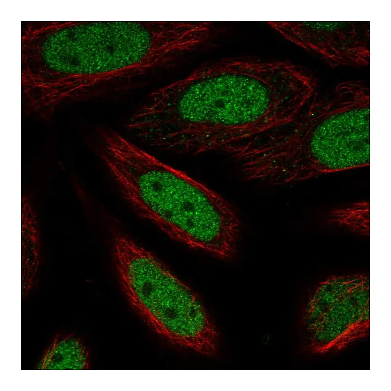 Atlas Antibodies Anti-ZBTB6 Antibody
