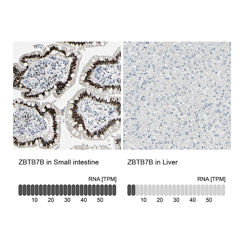 Atlas Antibodies Anti-ZBTB7B Antibody