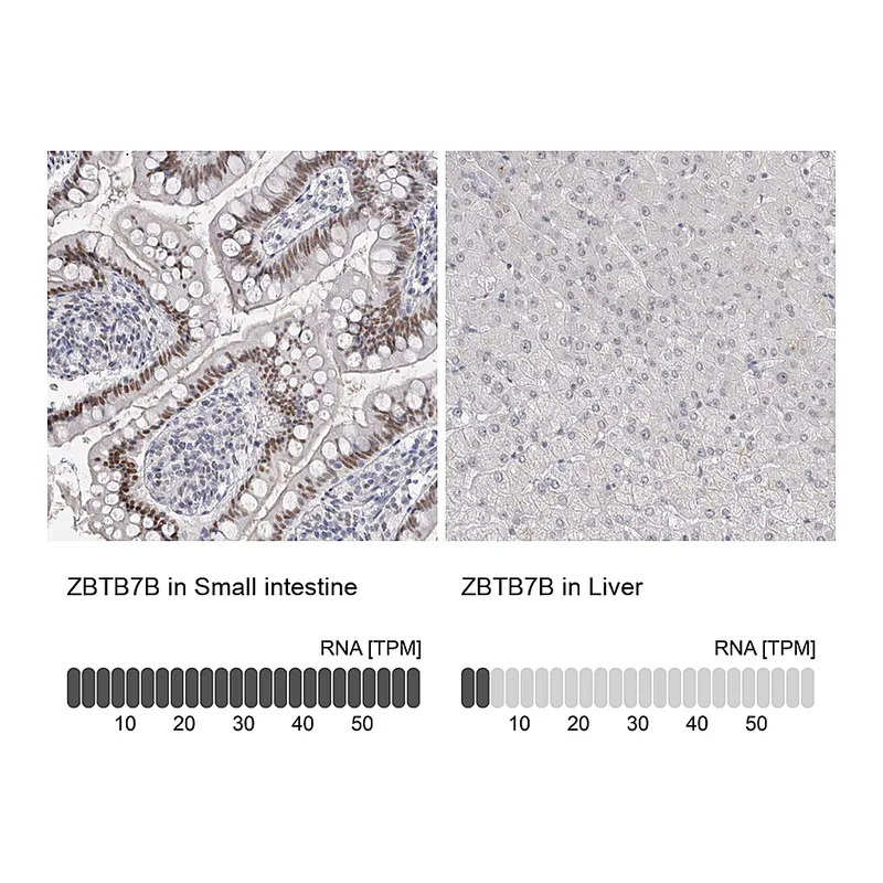 Atlas Antibodies Anti-ZBTB7B Antibody