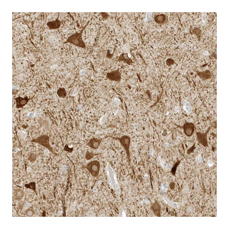 Atlas Antibodies Anti-ZBTB8A Antibody