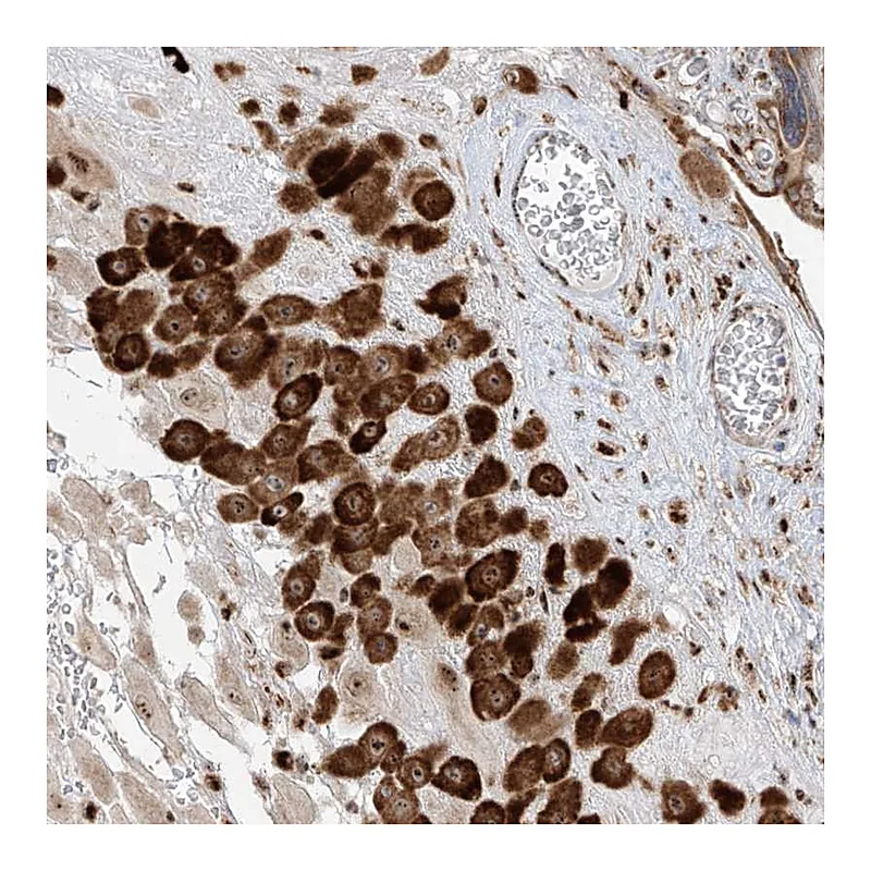 Atlas Antibodies Anti-ZBTB8A Antibody