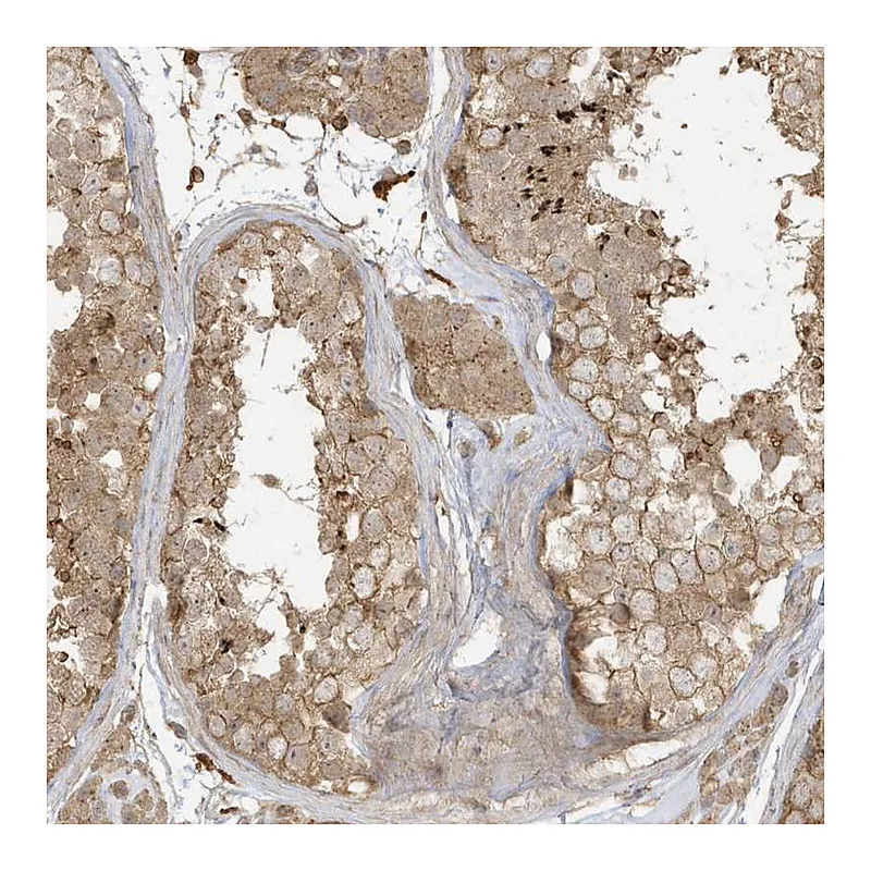 Atlas Antibodies Anti-ZBTB8A Antibody