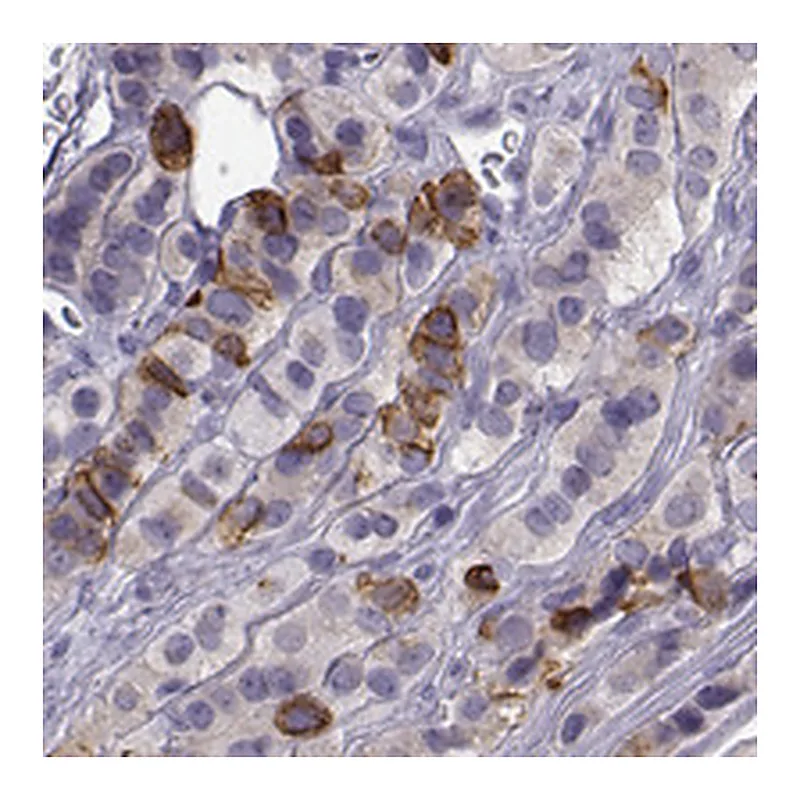 Atlas Antibodies Anti-ZBTB8B Antibody