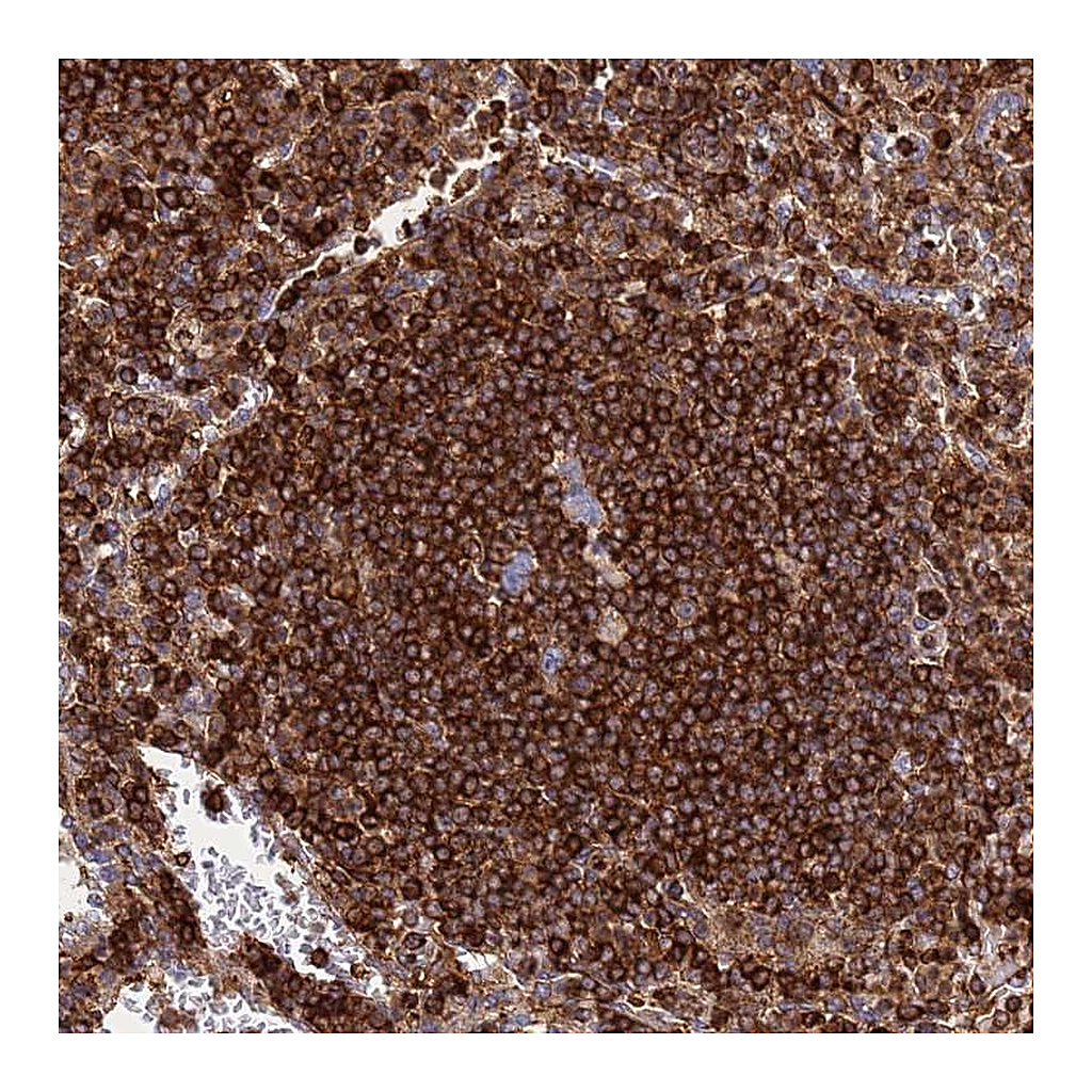 Atlas Antibodies Anti-ZBTB8OS Antibody