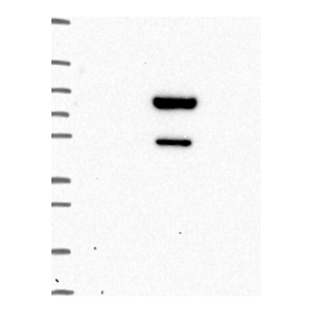 Atlas Antibodies Anti-ZBTB9 Antibody