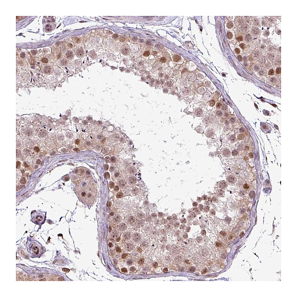 Atlas Antibodies Anti-ZC2HC1C Antibody