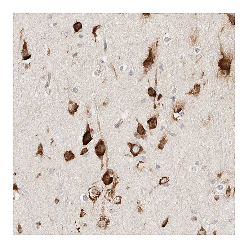 Atlas Antibodies Anti-ZC2HC1A Antibody