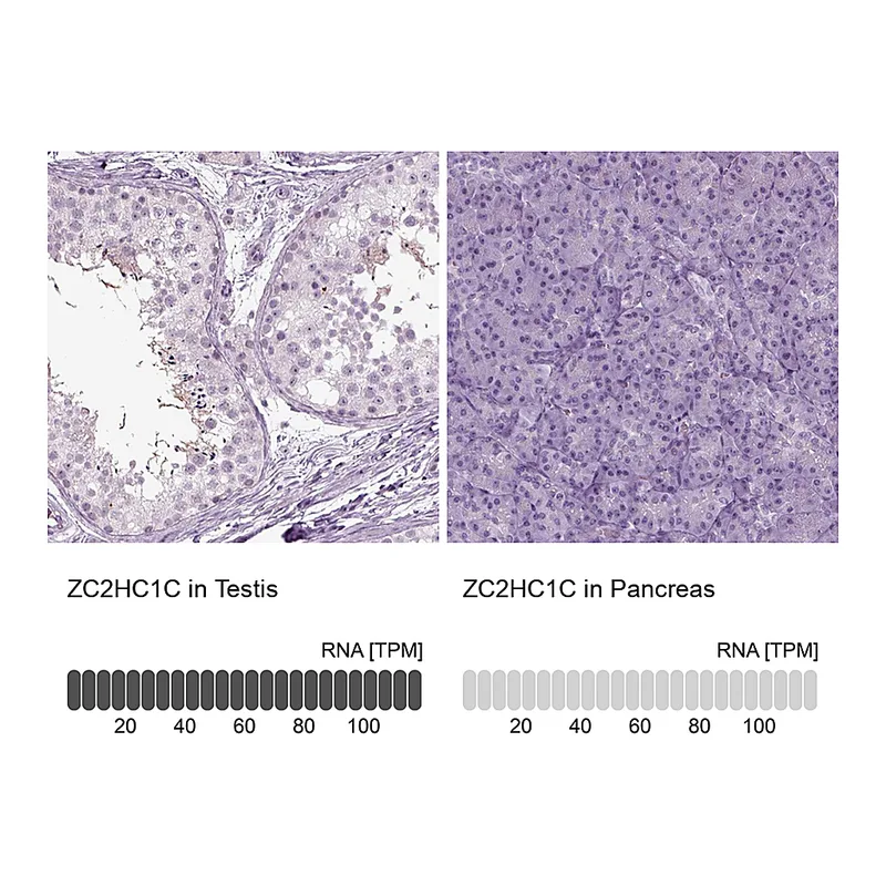 Atlas Antibodies Anti-ZC2HC1C Antibody