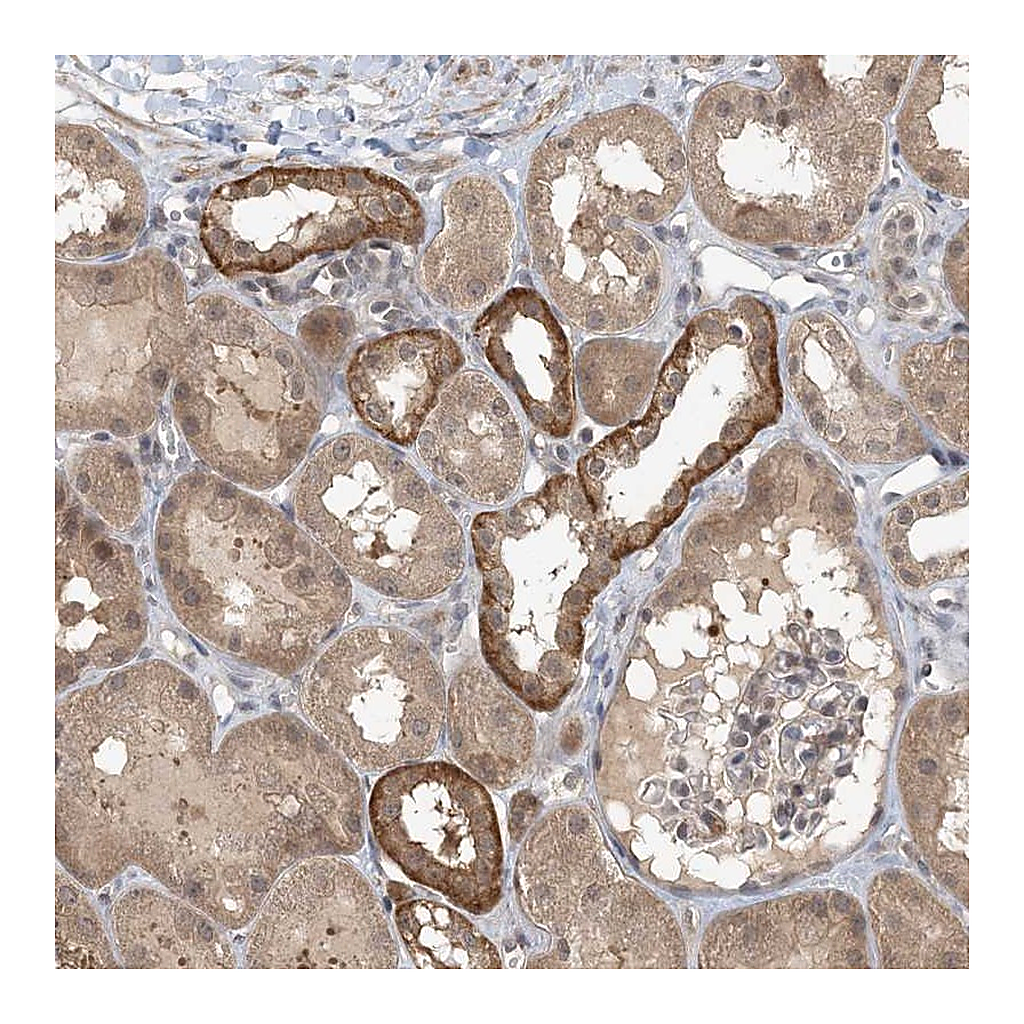 Atlas Antibodies Anti-ZC3H12A Antibody