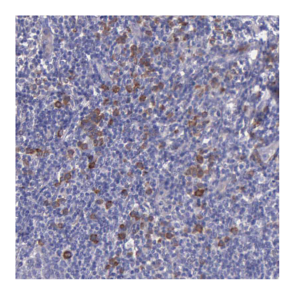 Atlas Antibodies Anti-ZC3H12B Antibody