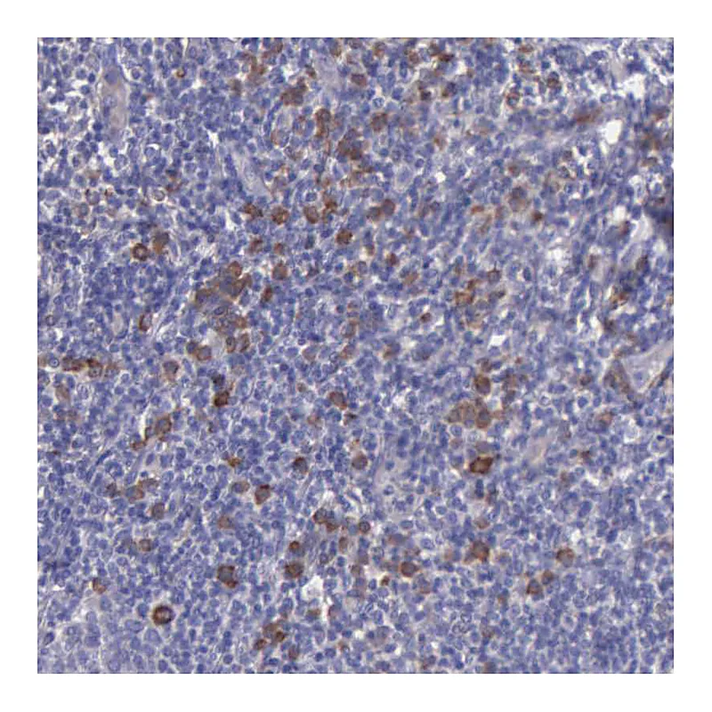 Atlas Antibodies Anti-ZC3H12B Antibody