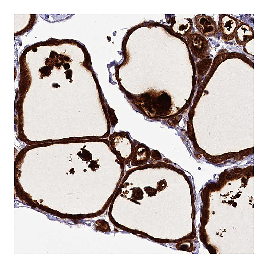 Atlas Antibodies Anti-ZC3H12C Antibody