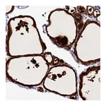 Atlas Antibodies Anti-ZC3H12C Antibody