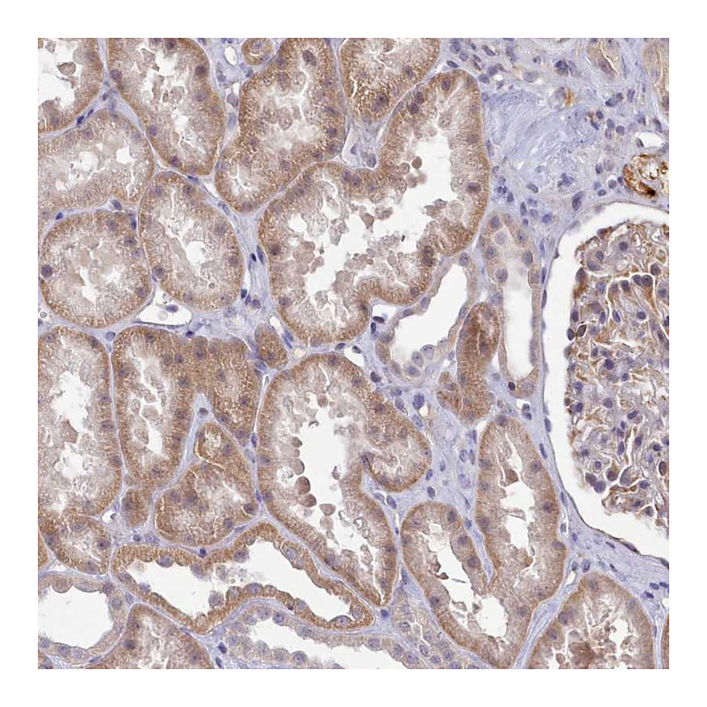 Atlas Antibodies Anti-ZC3H13 Antibody