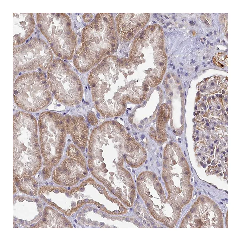 Atlas Antibodies Anti-ZC3H13 Antibody