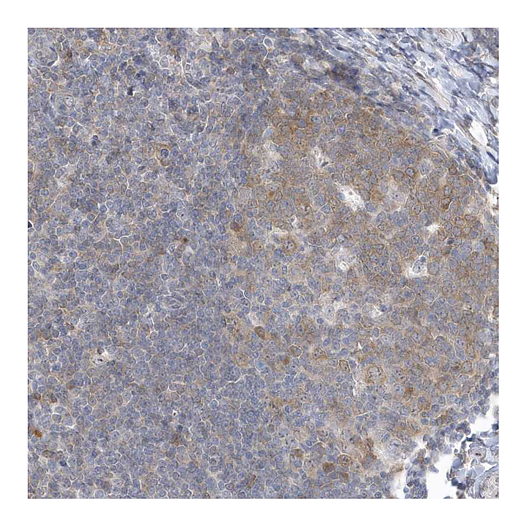 Atlas Antibodies Anti-ZC3H12D Antibody