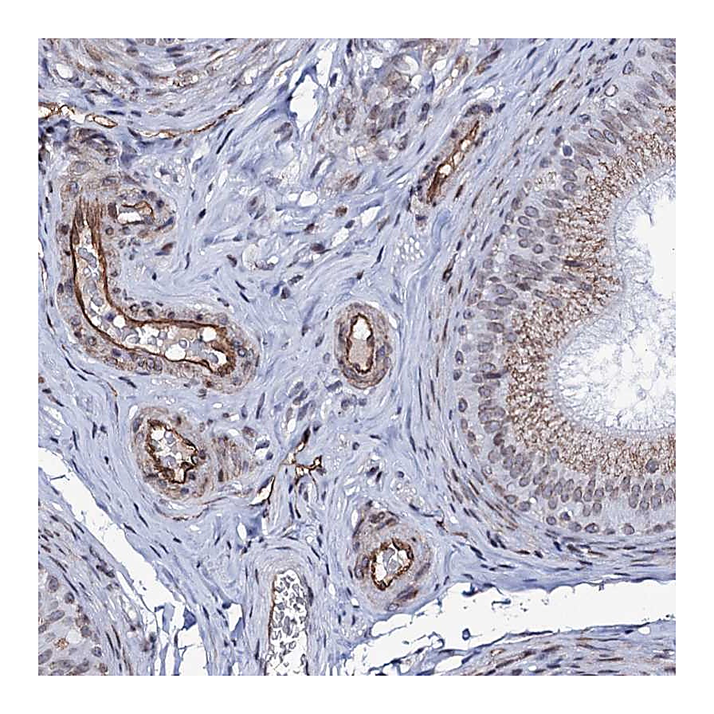 Atlas Antibodies Anti-ZC3H12C Antibody