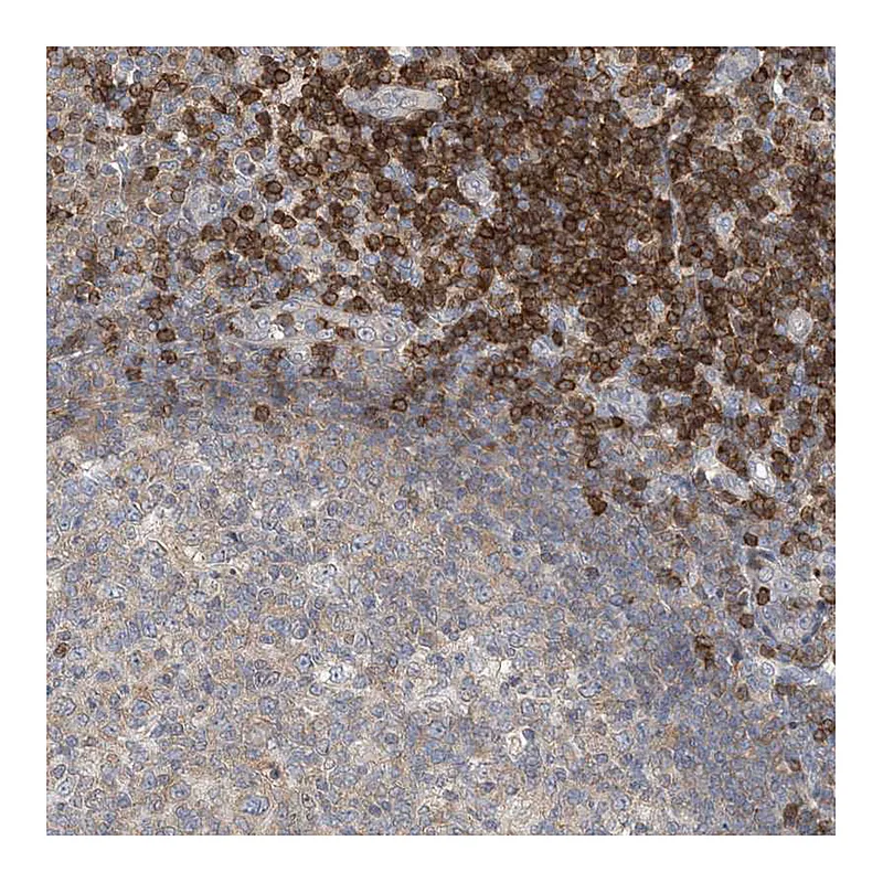 Atlas Antibodies Anti-ZC3H12A Antibody