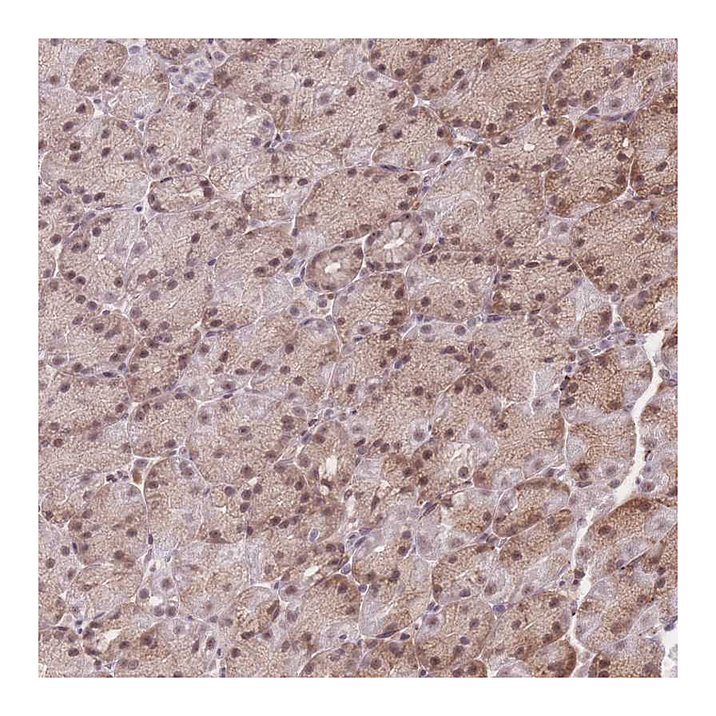 Atlas Antibodies Anti-ZC3H13 Antibody