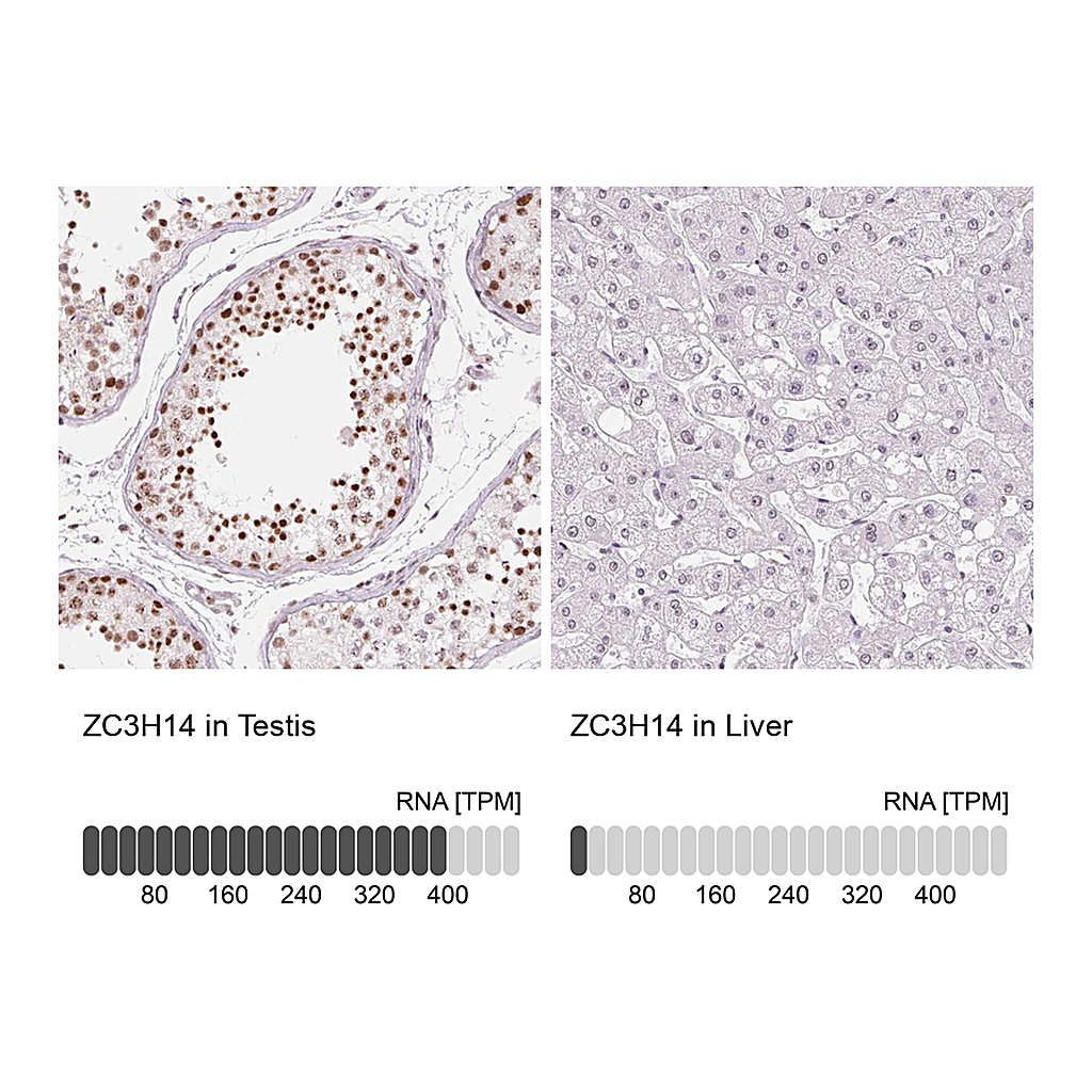 Atlas Antibodies Anti-ZC3H14 Antibody