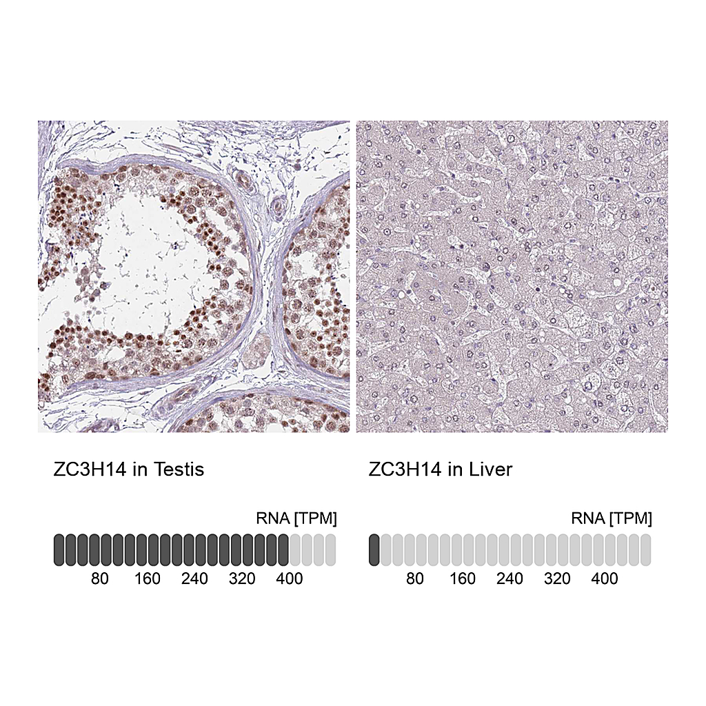 Atlas Antibodies Anti-ZC3H14 Antibody