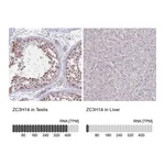 Atlas Antibodies Anti-ZC3H14 Antibody