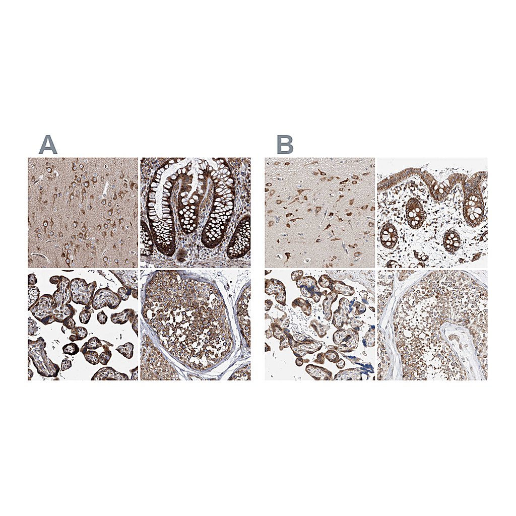 Atlas Antibodies Anti-ZC3H15 Antibody