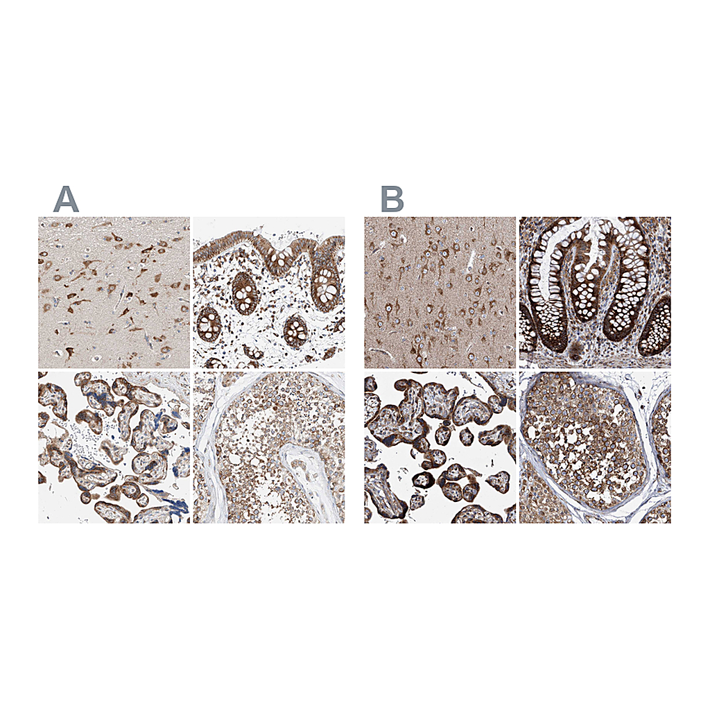 Atlas Antibodies Anti-ZC3H15 Antibody