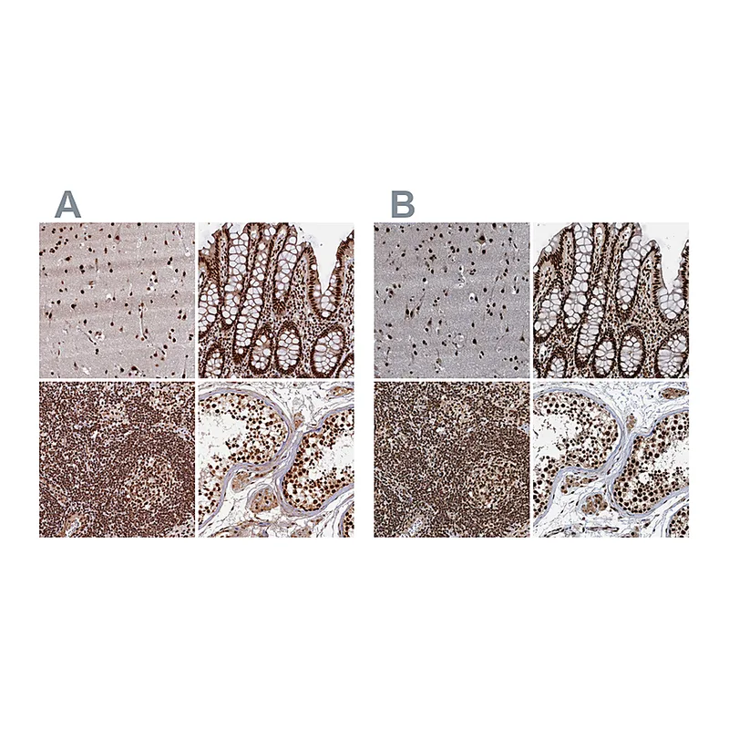 Atlas Antibodies Anti-ZC3H18 Antibody