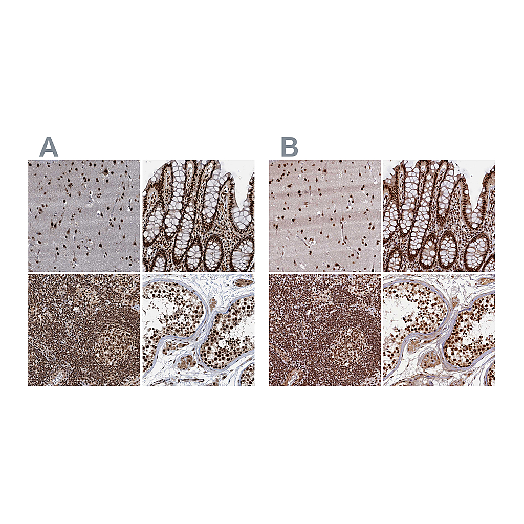 Atlas Antibodies Anti-ZC3H18 Antibody