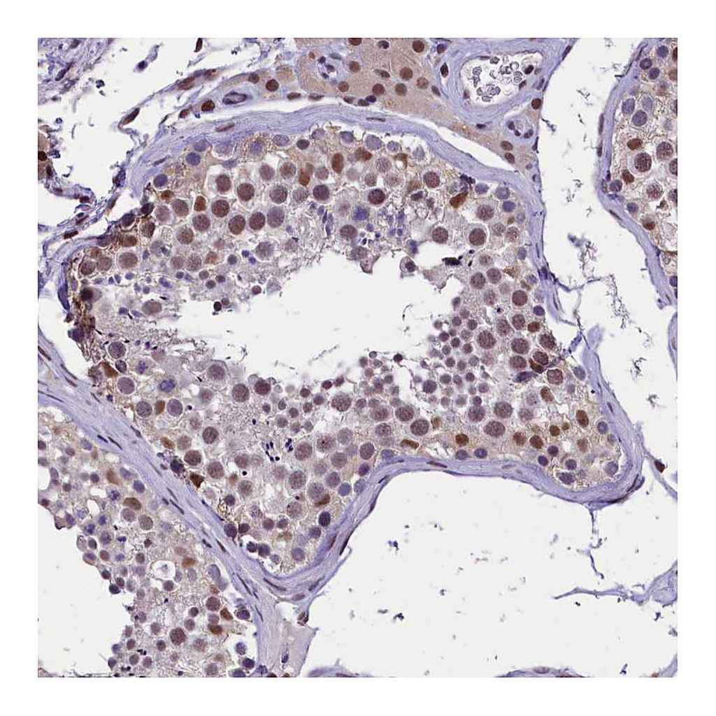 Atlas Antibodies Anti-ZC3H4 Antibody