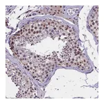 Atlas Antibodies Anti-ZC3H4 Antibody