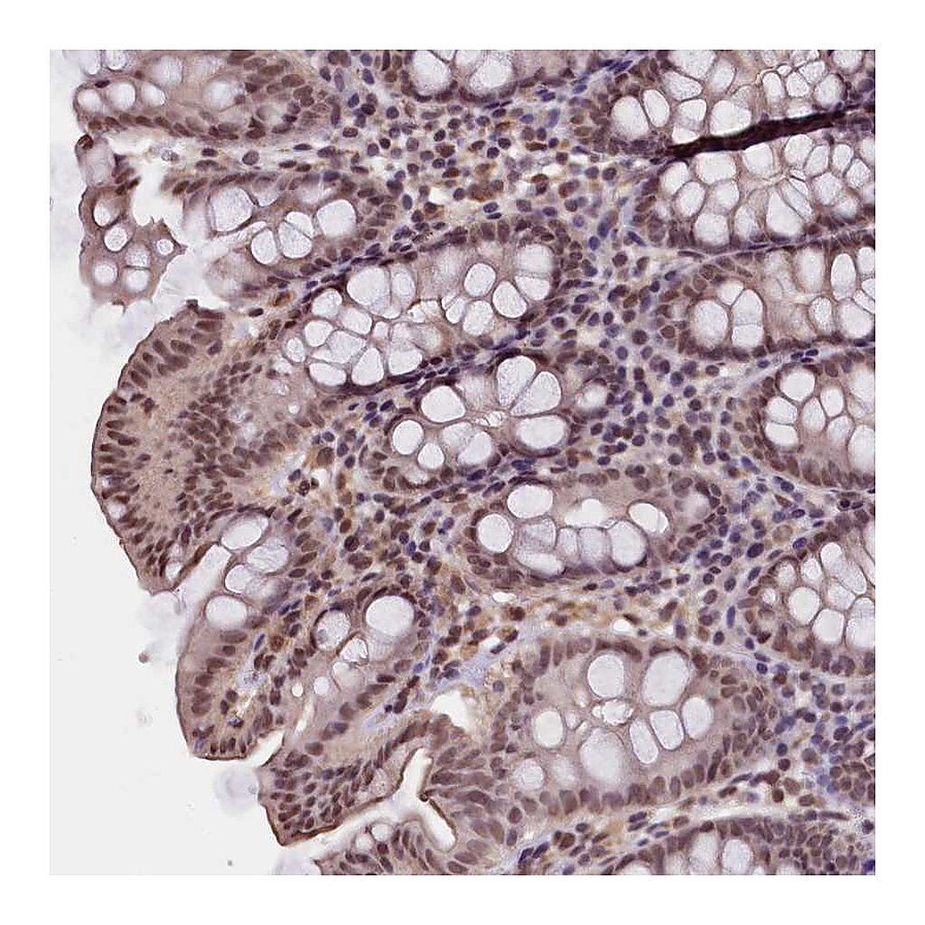 Atlas Antibodies Anti-ZC3H4 Antibody