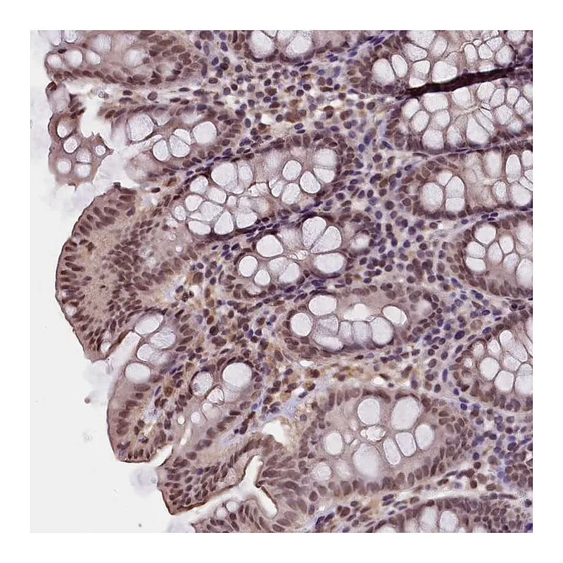 Atlas Antibodies Anti-ZC3H4 Antibody