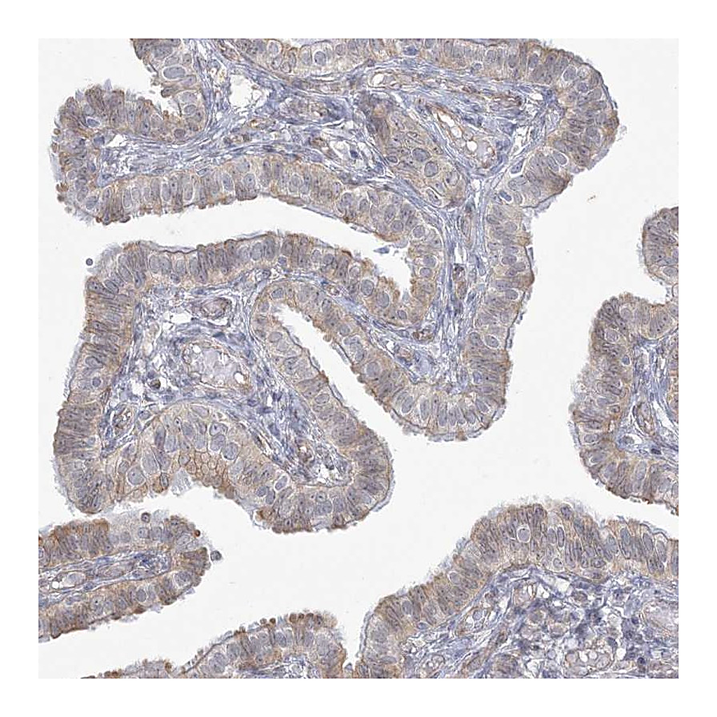 Atlas Antibodies Anti-ZC3H6 Antibody