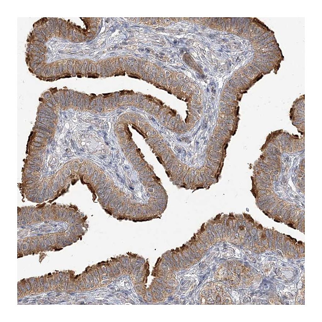 Atlas Antibodies Anti-ZC3H6 Antibody