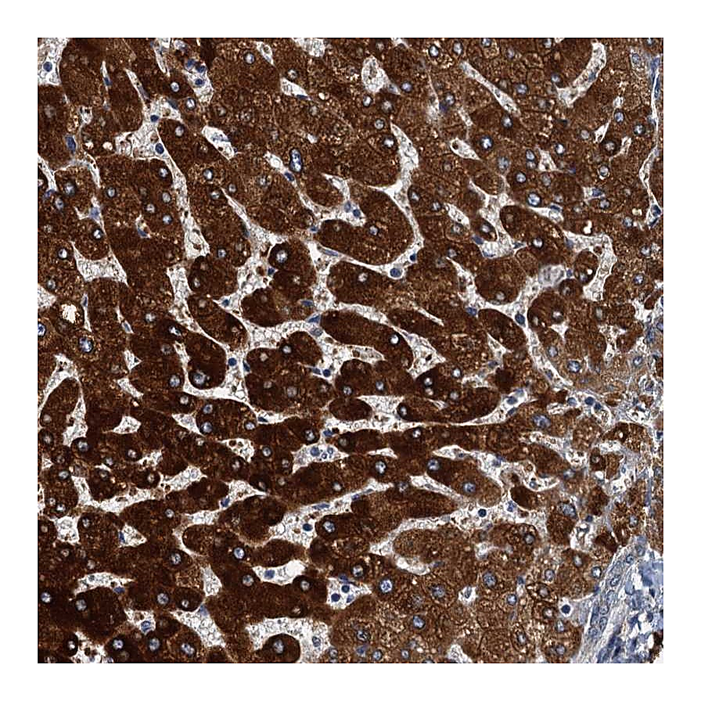Atlas Antibodies Anti-ZC3H7A Antibody