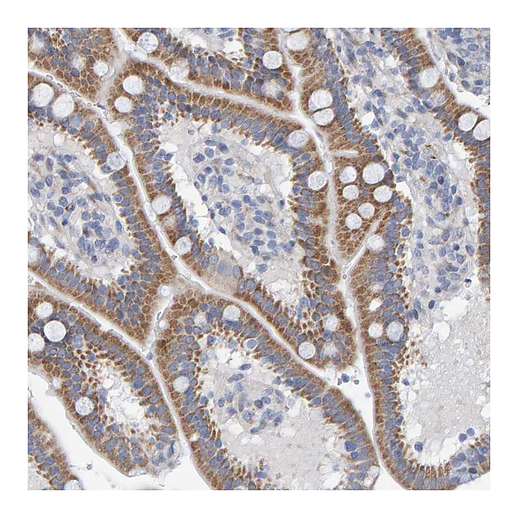 Atlas Antibodies Anti-ZC3H3 Antibody