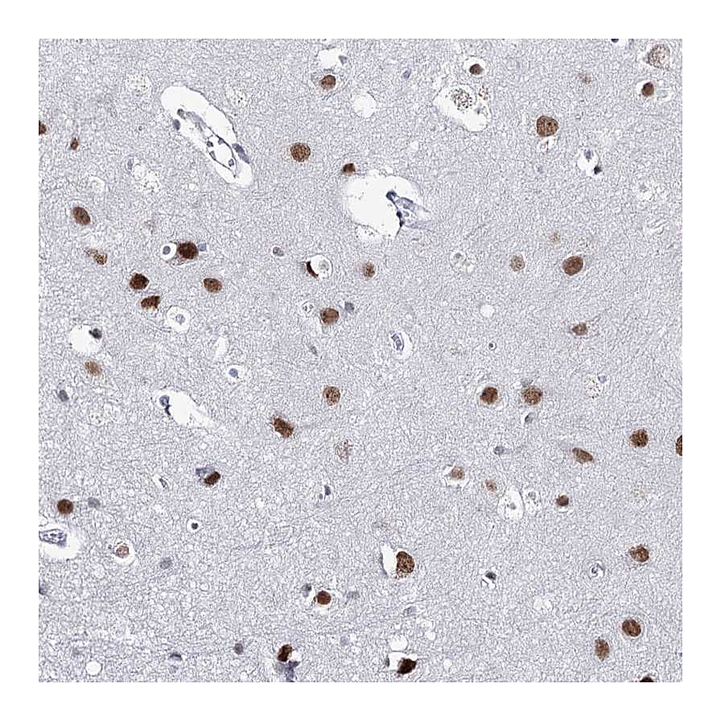 Atlas Antibodies Anti-ZC3H8 Antibody