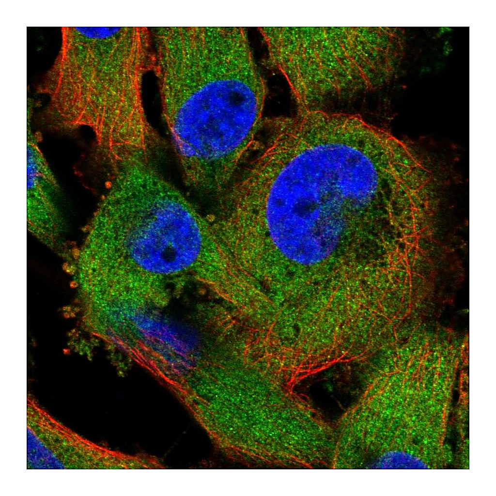 Atlas Antibodies Anti-ZC3HAV1 Antibody