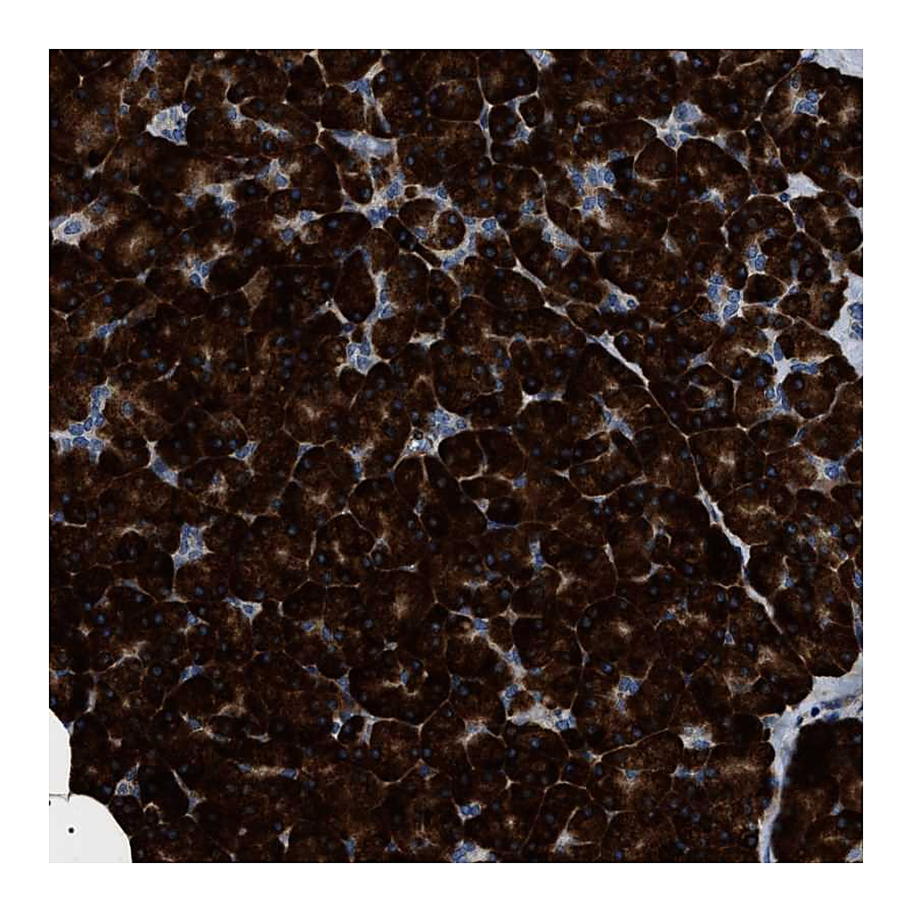 Atlas Antibodies Anti-ZC3HAV1L Antibody