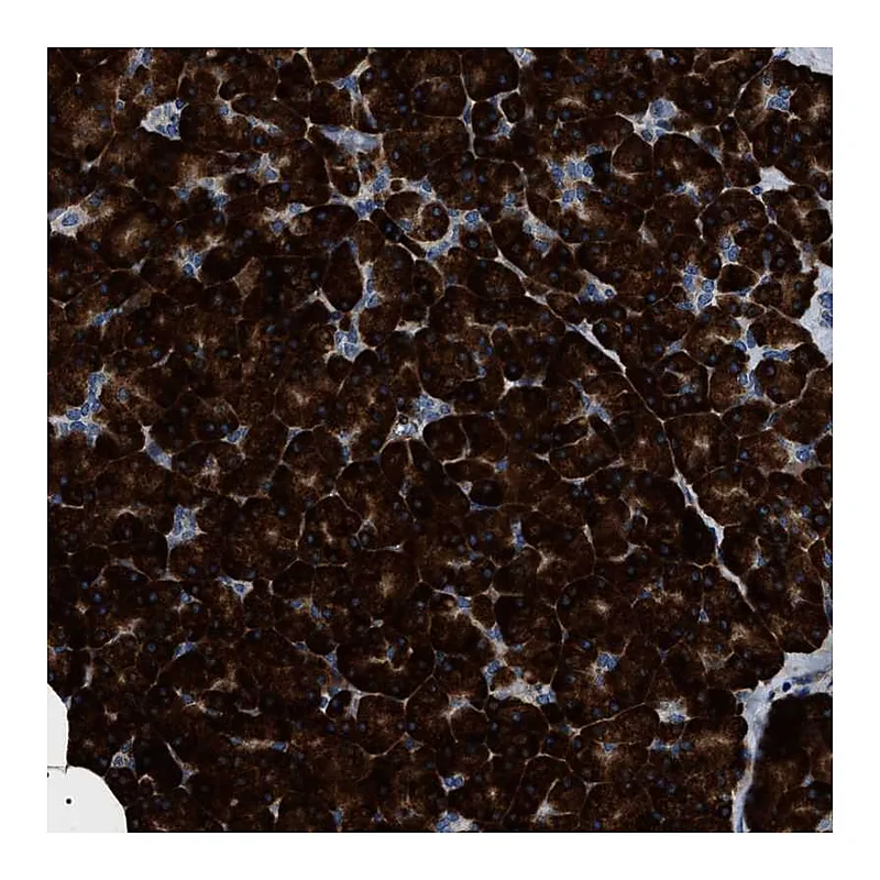 Atlas Antibodies Anti-ZC3HAV1L Antibody