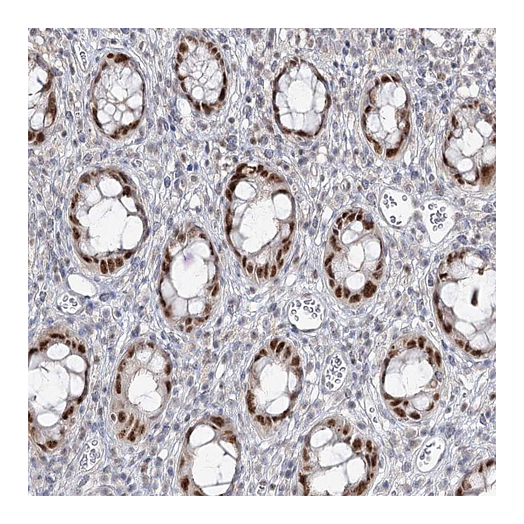 Atlas Antibodies Anti-ZC3H8 Antibody