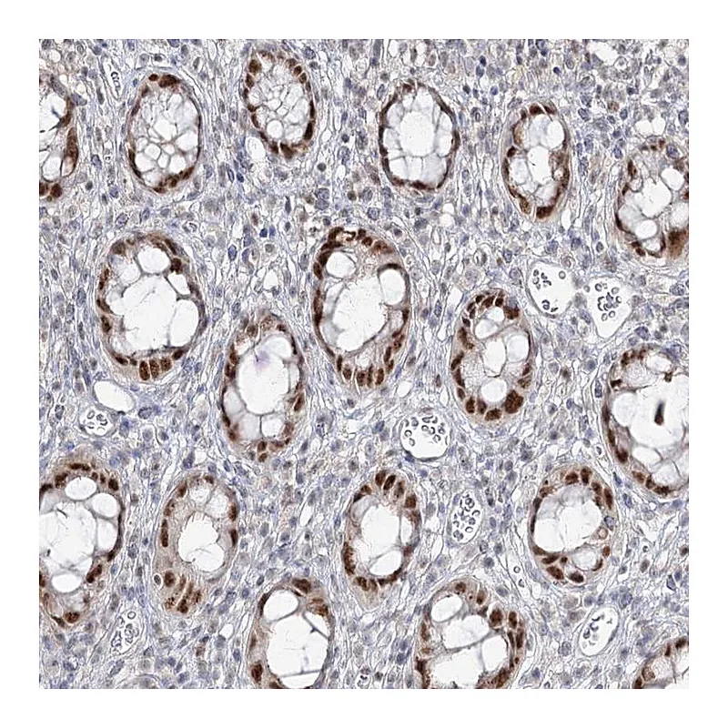 Atlas Antibodies Anti-ZC3H8 Antibody